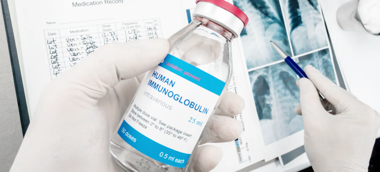 Artigo   Noticia   Importacao Imunoglobulina Humana capa blog